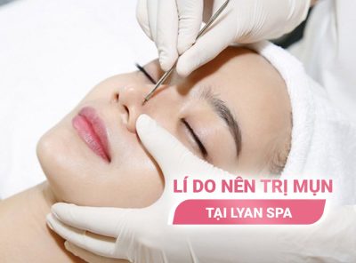 5 Lý do tại thanh hóa nên trị mụn tại LYAN Spa