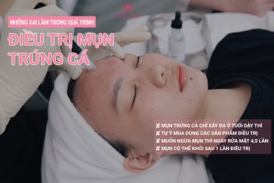 điều trị mụn tại thanh hóa